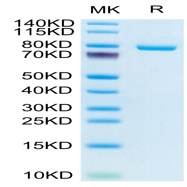 Human Transferrin R/CD71 Protein (TFR-HM401)