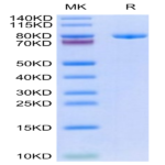 Biotinylated Human Transferrin R/CD71 Protein (TFR-HM401B)