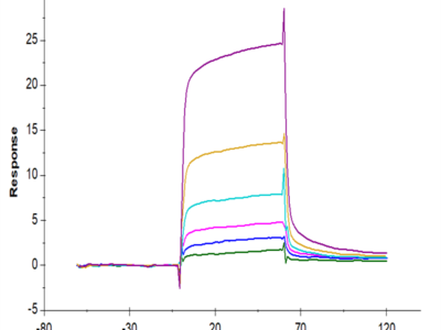 Human Mature TGF beta 1 Protein (TG1-HM00M)