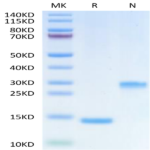 Human Mature TGF beta 1 Protein (TG1-HM00M)
