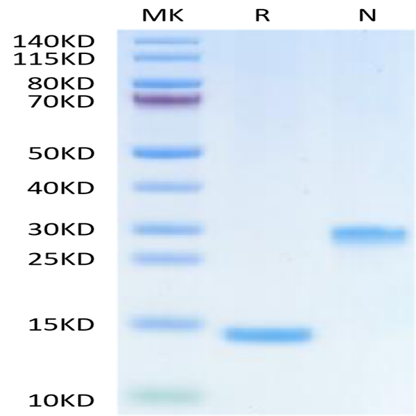 Human Mature TGF beta 1 Protein (TG1-HM00M)