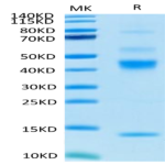 Human Latent TGF beta 1/TGFB1 Protein (TG1-HM401)