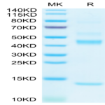 Biotinylated Human Latent TGF beta 1/TGFB1 Protein (TG1-HM401B)