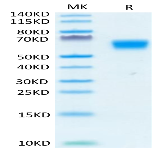 Human TGF-beta RII/TGFBR2 Protein (TGF-HM3R2)