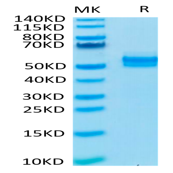 Human TGF-beta RII/TGFBR2 Protein (TGF-HM5R2)