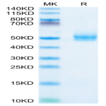 Human TGFBR1 Protein (TGF-HM6R1)