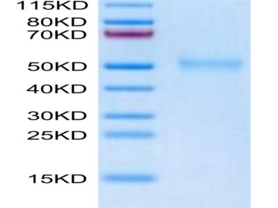 Biotinylated Human TGFBR1 Protein (TGF-HM6R1B)