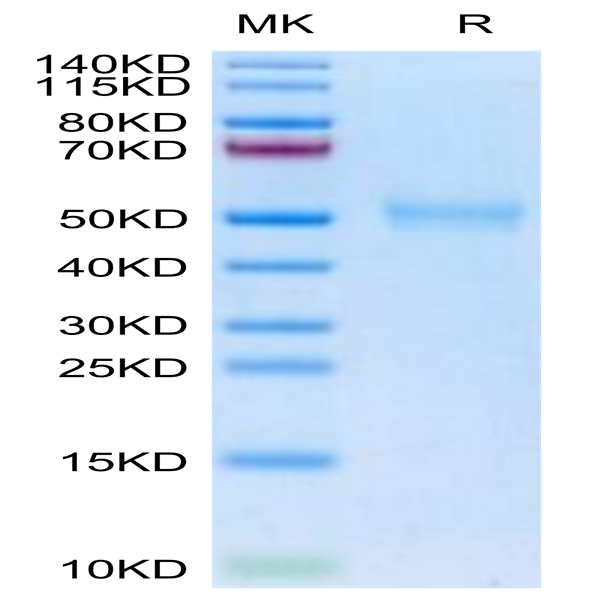 Biotinylated Human TGFBR1 Protein (TGF-HM6R1B) Biotinylated Human TGFBR1 Protein (TGF-HM6R1B)