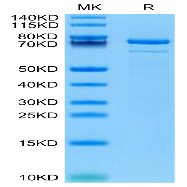 Human TGM2 Protein (TGM-HE102)