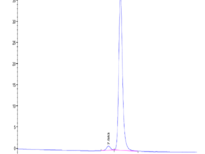 Human TIE1 Protein (TIE-HM101)