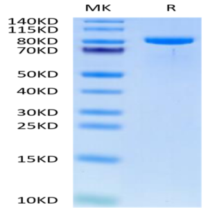 Human TIE1 Protein (TIE-HM101)