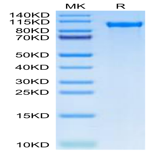 Human TIE2 Protein (TIE-HM201)