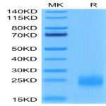 Human TIGIT Protein (TIG-HM110)
