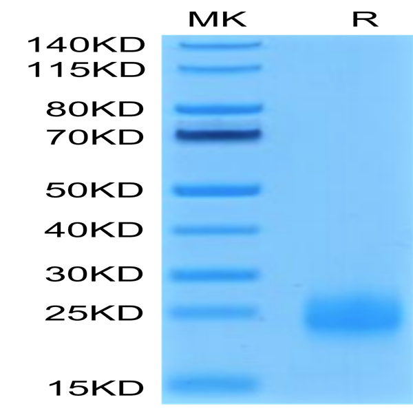 Human TIGIT Protein (TIG-HM110)