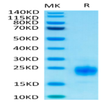 Biotinylated Human TIGIT Protein (TIG-HM410B)
