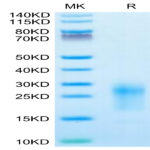 Mouse TIGIT Protein (TIG-MM110)