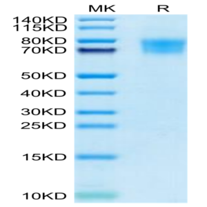 Cynomolgus TIM4 Protein (TIM-CM104)