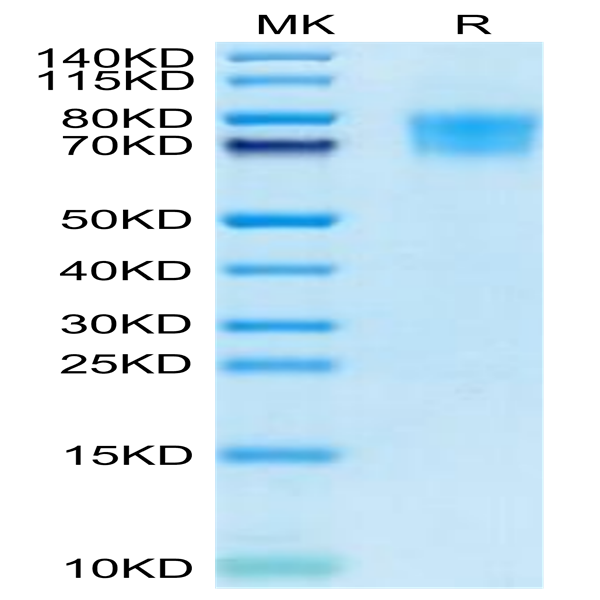 Cynomolgus TIM4 Protein (TIM-CM104)