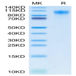Human TIM-1/HAVCR1 Protein (TIM-HM101)