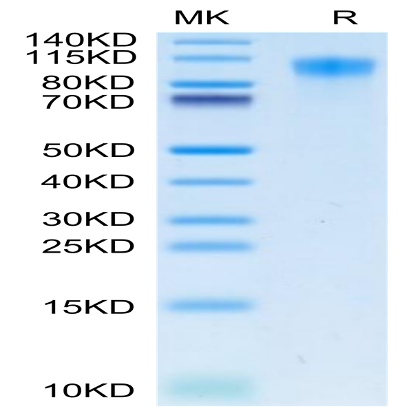 Human TIM-1/HAVCR1 Protein (TIM-HM101)