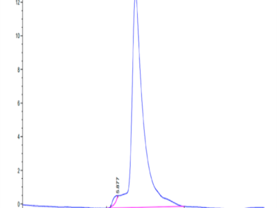 Human TIM-4 Protein (TIM-HM104)