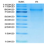 Human TIM-4 Protein (TIM-HM104)