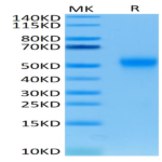 Human Tim-3/HAVCR2 Protein (TIM-HM131)