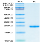 Human TIMP-2 Protein (TIM-HM1P2)