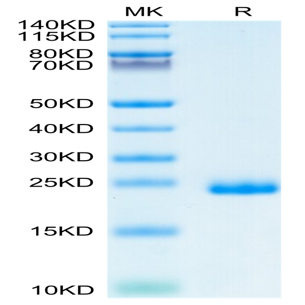 Human TIMP-2 Protein (TIM-HM1P2)