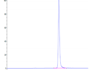 Human TIMP1 Protein (TIM-HM201)