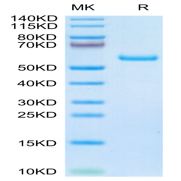 Human TIMP1 Protein (TIM-HM201)