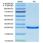 Mouse TIMP-2 Protein (TIM-MM1P2)