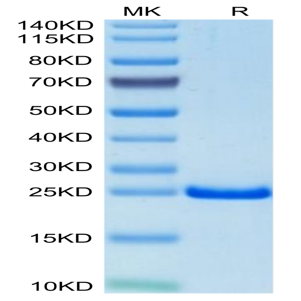 Mouse TIMP-2 Protein (TIM-MM1P2)