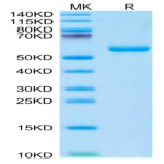 Mouse TIMP1 Protein (TIM-MM201)