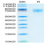Human TrkB/NTRK2 Protein (TKB-HM101)