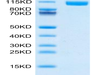 Biotinylated Human TLR3 Protein (Primary Amine Labeling) (TLR-HM103B)