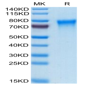 Human TREML2/TLT-2 Protein (TLT-HM102)