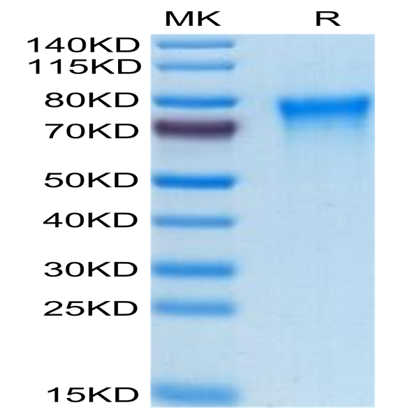 Human TREML2/TLT-2 Protein (TLT-HM102)
