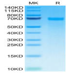 Human Tenascin Protein (TNC-HM101)