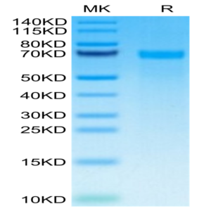 Human Tenascin Protein (TNC-HM101)