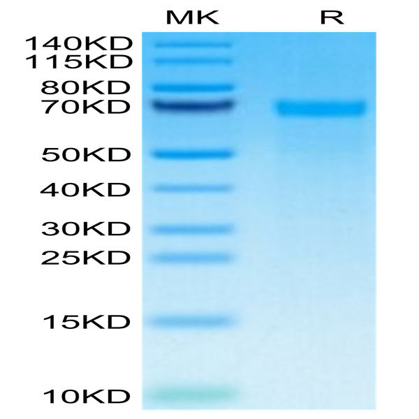 Human Tenascin Protein (TNC-HM101)
