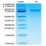 Mouse Tenascin Protein (TNC-MM101)