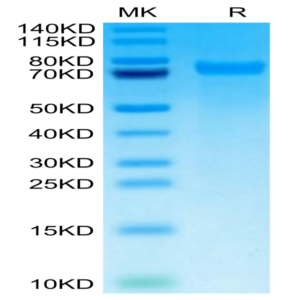 Mouse Tenascin Protein (TNC-MM101)