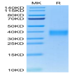 Cynomolgus TNFR1/CD120a/TNFRSF1A Protein (TNF-CM1R1)