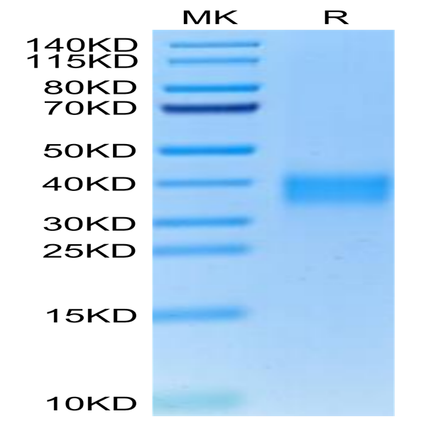 Cynomolgus TNFR1/CD120a/TNFRSF1A Protein (TNF-CM1R1)