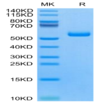 Human TNFRSF19 Protein (TNF-HM119)