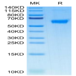 Human TNFRSF11B Protein (TNF-HM11B)