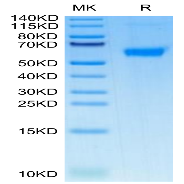 Human TNFRSF11B Protein (TNF-HM11B)