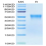 Biotinylated Human TNFR2/CD120b/TNFRSF1B Protein (Primary Amine Labeling) (TNF-HM1R2B)