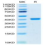 Human TNFRSF12A/TWEAKR Protein (TNF-HM20A)